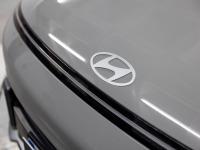 Hyundai Kona 1.0 TGDI Tecno