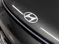 Hyundai Kona 1.0 TGDI Tecno
